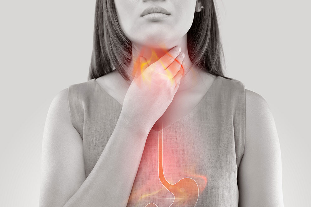 GERD – What to Eat and Avoid