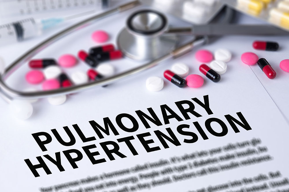 Incorporate These Changes to Manage PAH