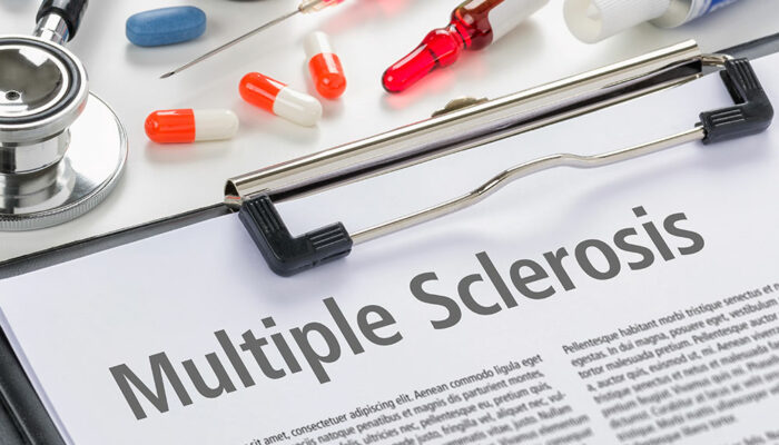 Understanding Different Aspects of Multiple Sclerosis