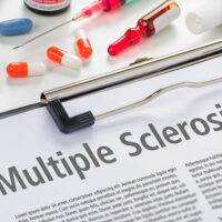 Understanding Different Aspects of Multiple Sclerosis