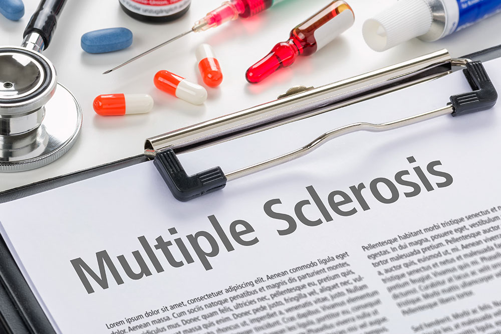 Understanding Different Aspects of Multiple Sclerosis